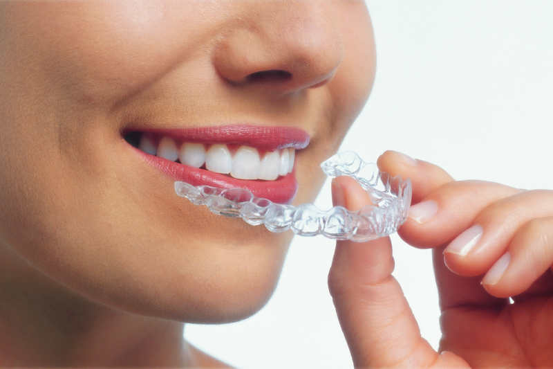 Invisalign in Ridgefield